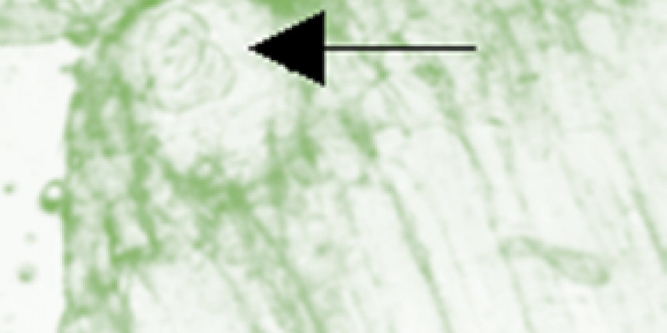 Indkapslet trikinlarve i muskel fra isbjørn. Billedet er taget via mikroskop. Foto:  VFMG / DTU